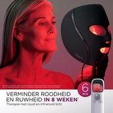 Shark FW312EUPL CryoGlow LED-Masker  9