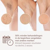 Philips BRI947/00 Lumea IPL 8000 Series IPL Ontharingsapparaat 4