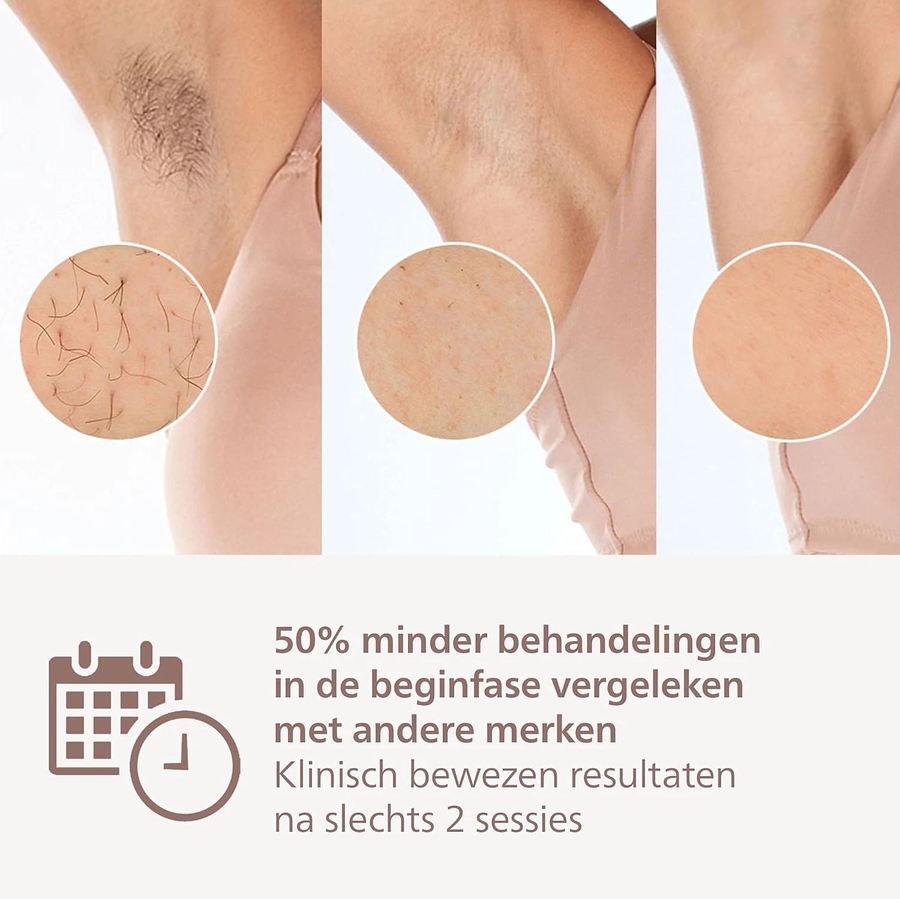 Philips BRI947/00 Lumea IPL 8000 Series IPL Ontharingsapparaat 4